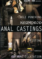 Anal Castings